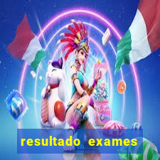 resultado exames unimed poa